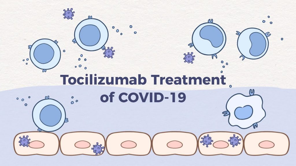 Tocilizumab u bolesnika s teškim oblikom COVID-19
